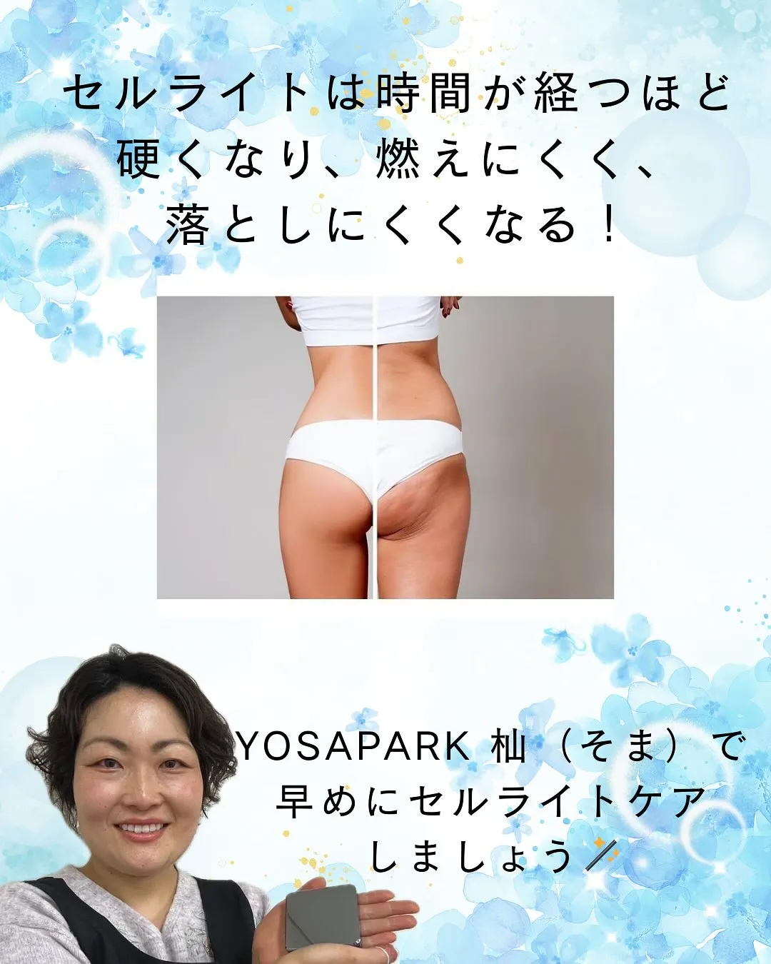 セルライトを溜め込む食生活があることご存知ですか?